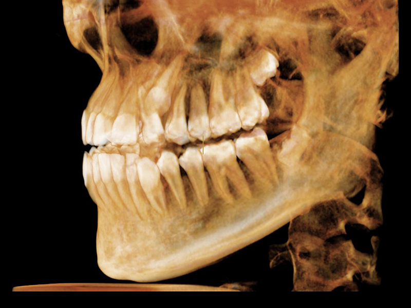 Cirugia maxilofacial